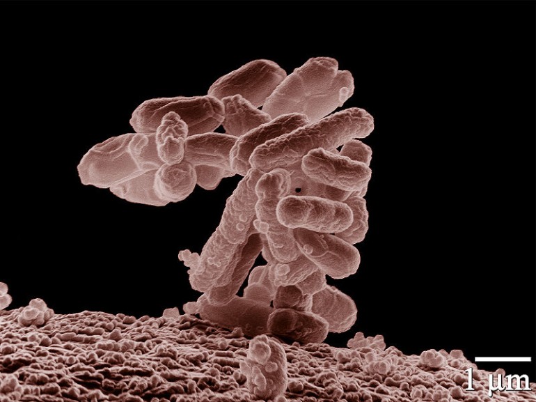 Новые способы использования озона и вирусов для убийства вредных бактерий
