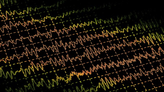 Клеточная трансплантация лечит эпилепсию у мышей